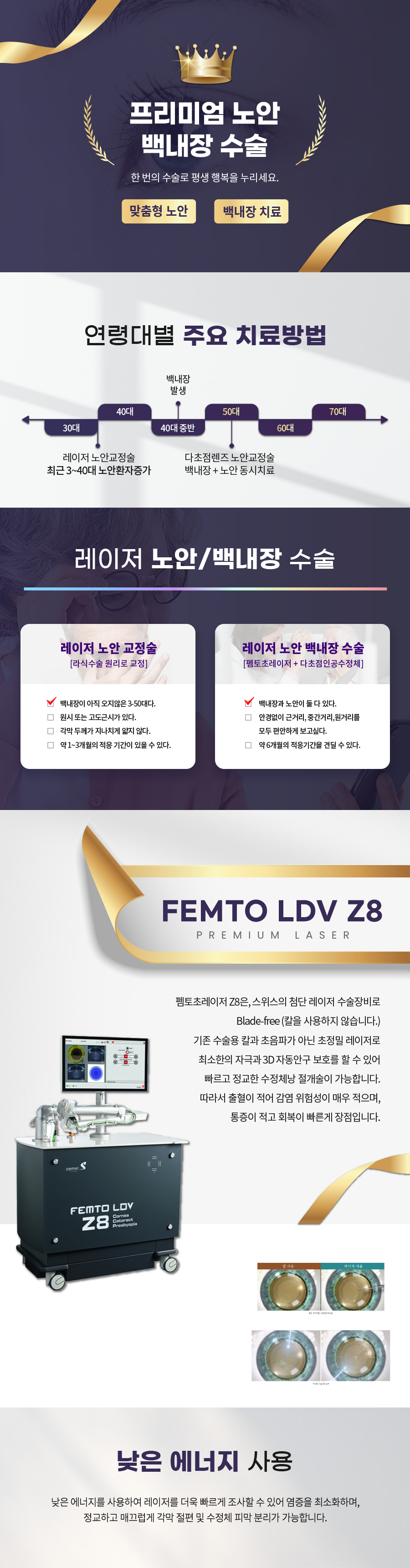 프리미엄백내장